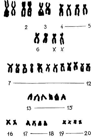 Хромосомы в клетке нормального человека